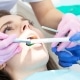 teeth-cleaning